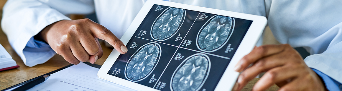 Brain X-ray on Tablet